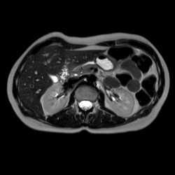 Брюшная полость и забрюшинное пространство