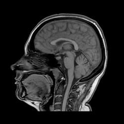 Головной мозг