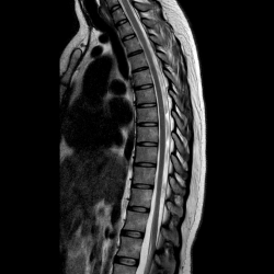 Грудной отдел позвоночника