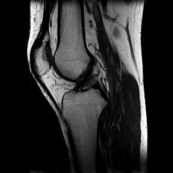 Коленный сустав