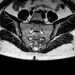 Крестцово-копчиковый отдел