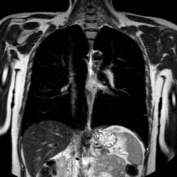 Легкие и средостение