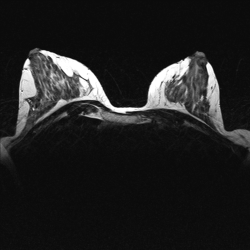 Молочные железы