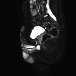 Мужские наружные половые органы