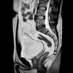 Мужской малый таз