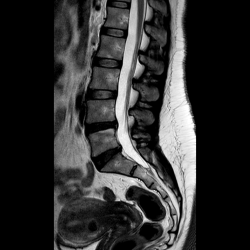 Поясничный отдел позвоночника