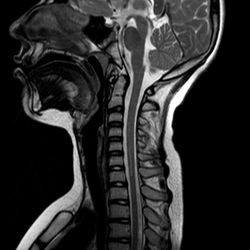 Шейный отдел позвоночника