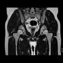 Тазобедренные суставы