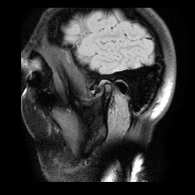 Височно-нижнечелюстные суставы