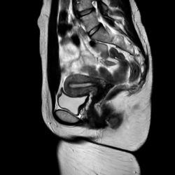 Женский малый таз