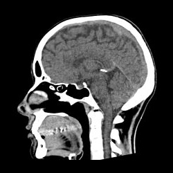 Головной мозг