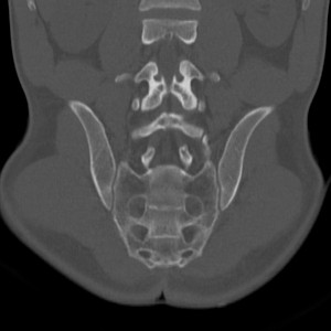 Крестцово-копчиковый отдел