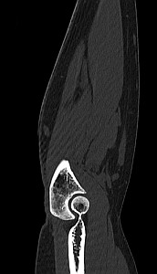 Локтевой сустав