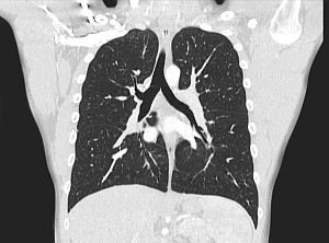 Органы грудной клетки