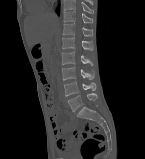 Поясничный отдел позвоночника