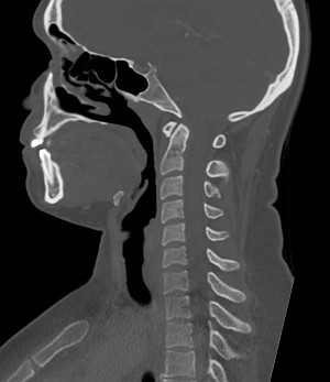 Шейный отдел позвоночника