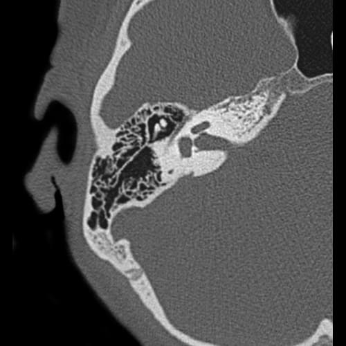 Височные кости